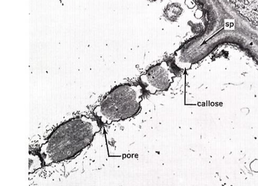 胼胝质电镜照片